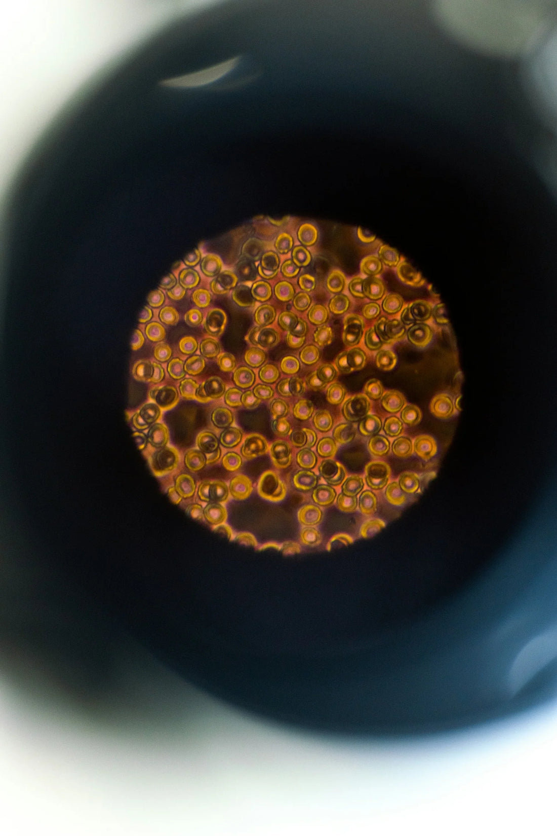 Bifidobacterium Longum