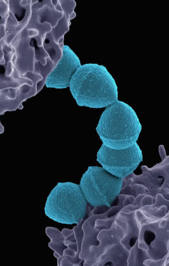 Lipase