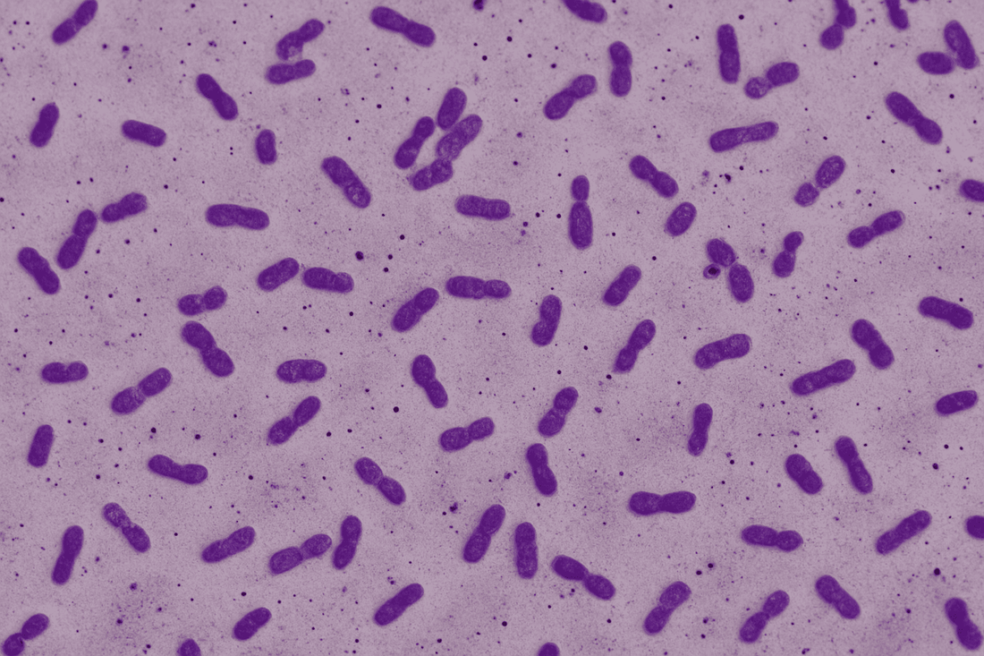 Protease